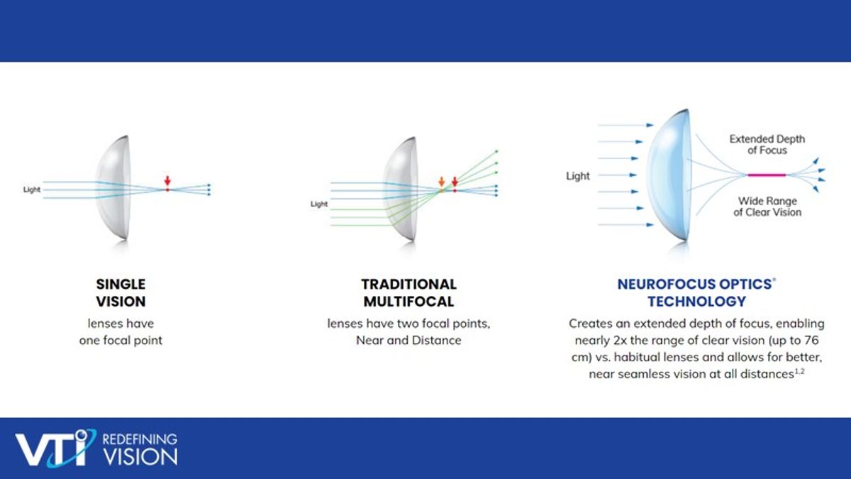 understanding-the-naturalvue-multifocal-contact-lens-myopia-profile