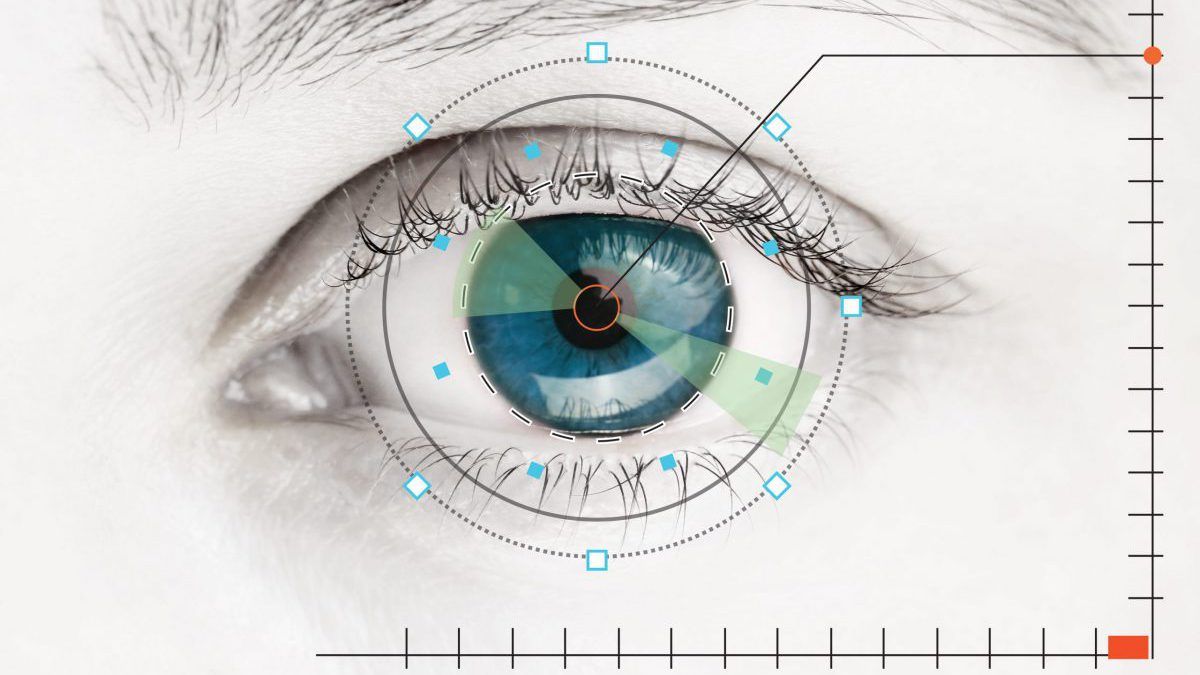 Examples of the variability of the red eye phenomenon. Golden eyes